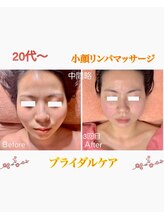 萬裡(マリン)/神保町ブライダルケア★首長美人