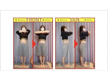 栄光治院 岡崎南院/肩こり/腰痛/産後/ダイエット