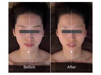 レーヴリゼ(Revelise)/頭蓋骨小顔矯正+整顔マッサージ