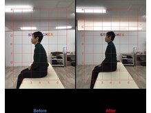 ストレチックス 近江八幡店/BeforeAfter