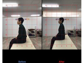 ストレチックス 近江八幡店/BeforeAfter