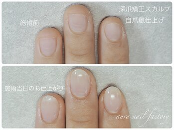 アウラ ネイル ファクトリー(aura nail factory)/深爪矯正スカルプ《自爪風》赤羽