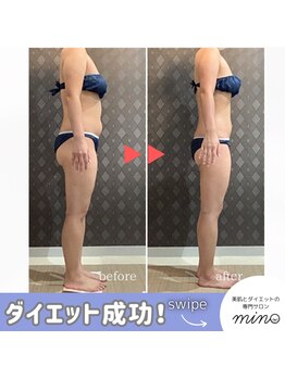 ミノ 美里大通り店(mino)/ダイエットパッケージプラン