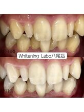 ホワイトニングラボ 八尾店(Whitening Labo)/ホワイトニング専門店/八尾