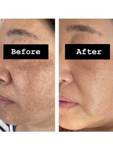 クラウドナイン(CLOUD NINE)