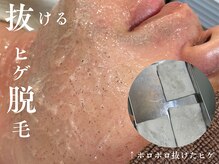 ザ エッセンシャル 碧南(THE Essential)/爆抜けヒゲ脱毛