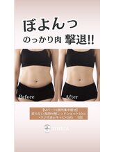 ジヒカ(ZIHICA)/ 【RED SHOT】気になる部分集中