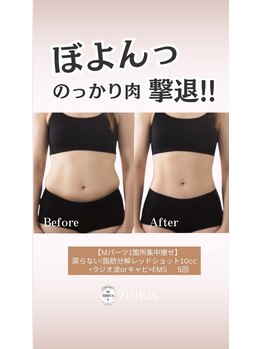 ジヒカ(ZIHICA)/ 【RED SHOT】気になる部分集中