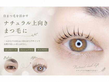 ソナ(Sona)の写真