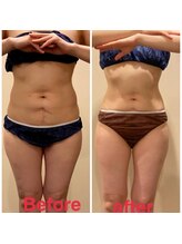 ナツミ(723)/美ボディ