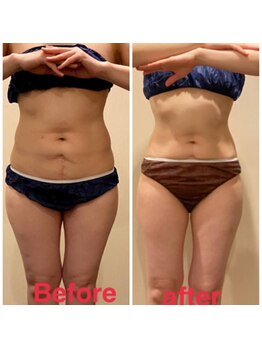 ナツミ(723)/美ボディ