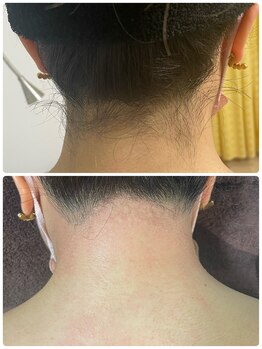 エン(en.)/BeforeAfter写真6