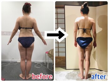 ルビーズ 柏店(RUBYZ)/ 5回施術／ボディラインの変化