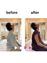 フィデル(fidele)/首の凝り改善【神宮前/表参道】