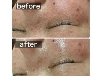 ナチュラ ソース(NatureSouce)/エイジングケア