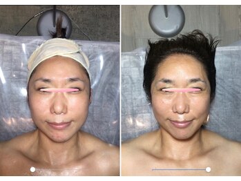 自然美人/小顔コルギの効果