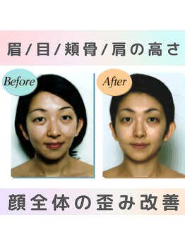 ロコモ 美容矯正サロン(Locomo)/左右対象の小顔：顔の歪み改善