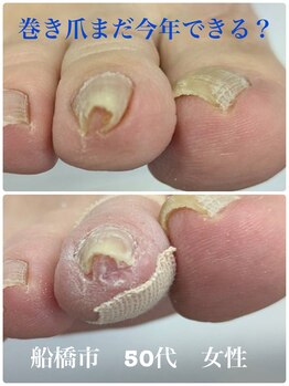 巻き爪じゅん 船橋店/巻き爪まだ年末お願いできます？
