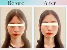 天空の手もみ/小顔矯正/吉祥寺/荻窪/西荻窪