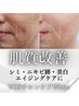 【美白・シミやたるみのエイジングケアに◎】VOSサロンケア（WHITE）