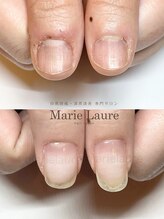 マリーロール 梅田店(Marie Laure)/深爪改善/自爪育成/ネイルケア