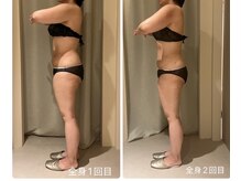 ドゥ ボーテ(de beaute)/40代セルゼロ痩身2回目♪