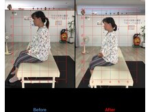 ストレチックス 近江八幡店/姿勢改善ビフォーアフター1回