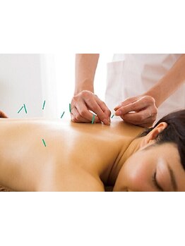 鍼灸施術を受けたい