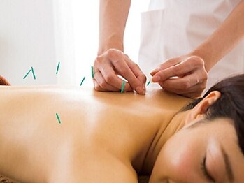 りっつ鍼灸院の写真/鍼灸歴20年以上のプロによる施術◎【全身×小顔×姿勢改善】120分の贅沢美容鍼コース!今だけ13,000円♪