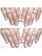 カフナ アンド チル(Kahuna&chill)/深爪矯正