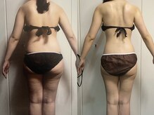 ロズアスールの雰囲気（ボディ痩身/痩身ダイエット/痩身リンパマッサージ/天王寺痩身）