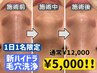 【5000円◇1日1名限定】超特別◆毛穴超ごっそり洗浄ハイドラ×人気美容液導入