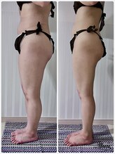 アイナ(aina)/足に自信！