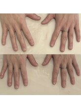 ハッカネイル(HAKKA NAIL)/