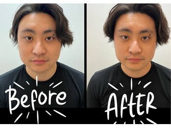 北島坂口鍼灸整骨院/小顔になりたい方へ！