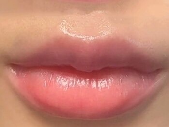 ビューティーサロン リリー(Lily)の写真/話題のローマピンクと脱毛をセットにしたお得なメニューをご用意いたしました！一度の施術で効果が持続♪