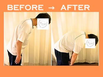 こころ整骨院/20代男性のビフォーアフター