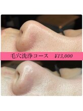 フェリーチェ(felice)/いちご鼻卒業！毛穴洗浄コース♪