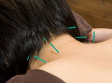 上毛鍼灸院/鍼灸