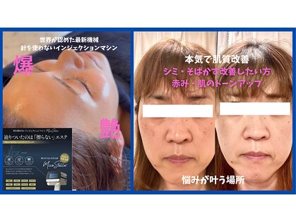 ガーベラ(Gerbera)の写真