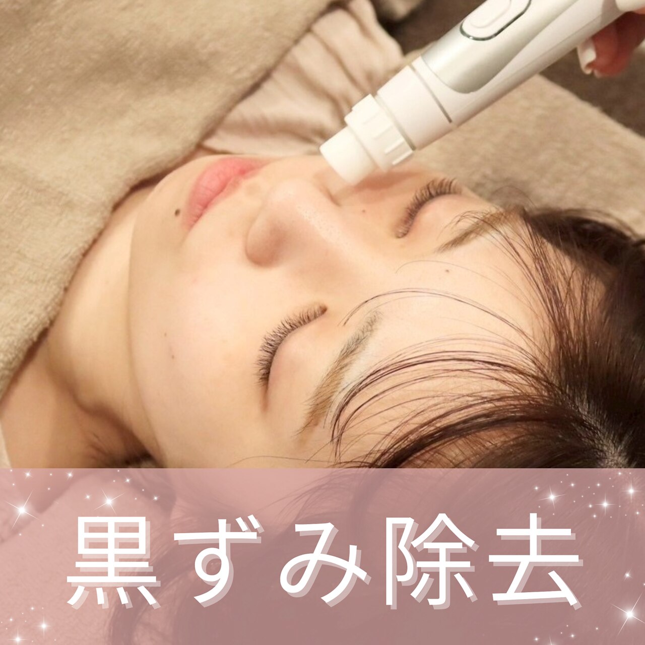 ☆【小鼻の黒ずみ除去】小顔矯正+3stepハイドラ毛穴洗浄+プラズマ\16,500→