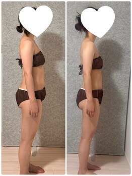 エミナル(EMINAL)/全身リンパ、骨盤調整 5回