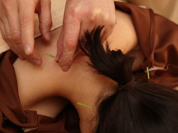 すやすや/京橋/都島/鍼灸/ヘッドスパ