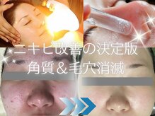 ナイア(naia)の雰囲気（短期集中がお勧め★ニキビケアは、だらだら続けず一気に改善！）