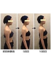 小顔フェイスラボ 春日井店(小顔 Face Labo.)/◆小顔&整体コルギで姿勢改善◆