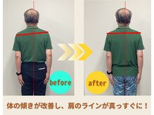 プレーバ(Preava)/姿勢の変化