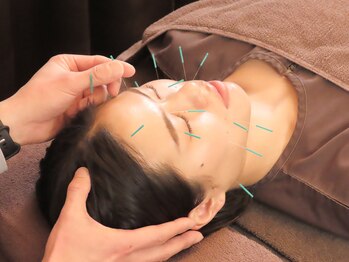 ハリコ 代官山/美容鍼コース