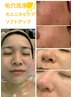 夏オススメ☆【ハイパーナイフ】＋【毛穴洗浄or毛穴引き締め】