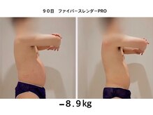 未来型スパエステ サリスパ(SARI SPA)/メンズビフォーアフター