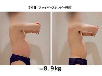 未来型スパエステ サリスパ(SARI SPA)/メンズビフォーアフター